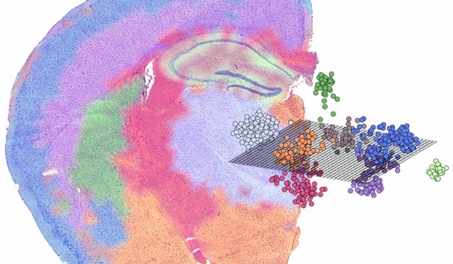 Spatial Transciptomics Tissue Graphic