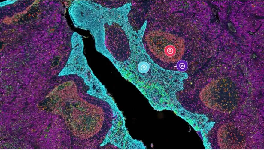 Spatial Image, purple, green, red, pink cell tissue, by Akoya