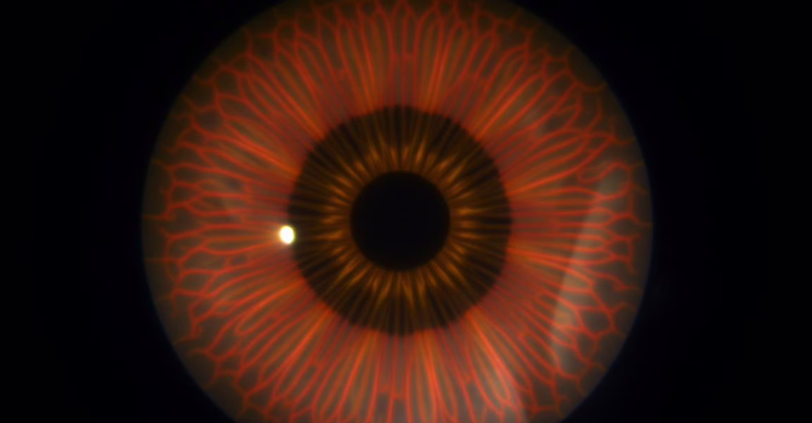 Corneal Endothelial Changes Observed After mRNA COVID-19 Vaccination