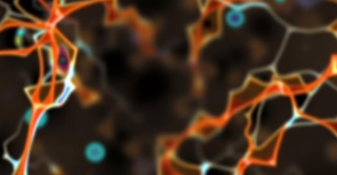 Predicting Success in CD3+ Cell Apheresis for CAR T Therapy in DLBCL