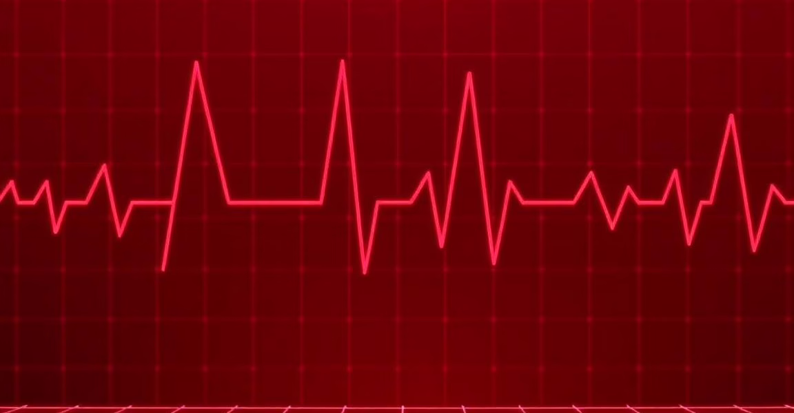 Understanding Atrial Fibrillation’s Impact on Cognitive Health